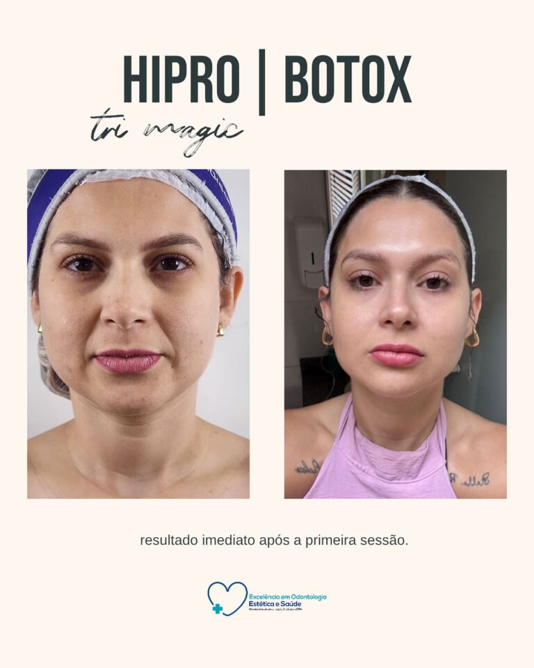 Artes e posts · Facecorp Estética Avançada, Saúde e Harmonização Oro Facial — Vila Imperial, São José do Rio Preto - SP
