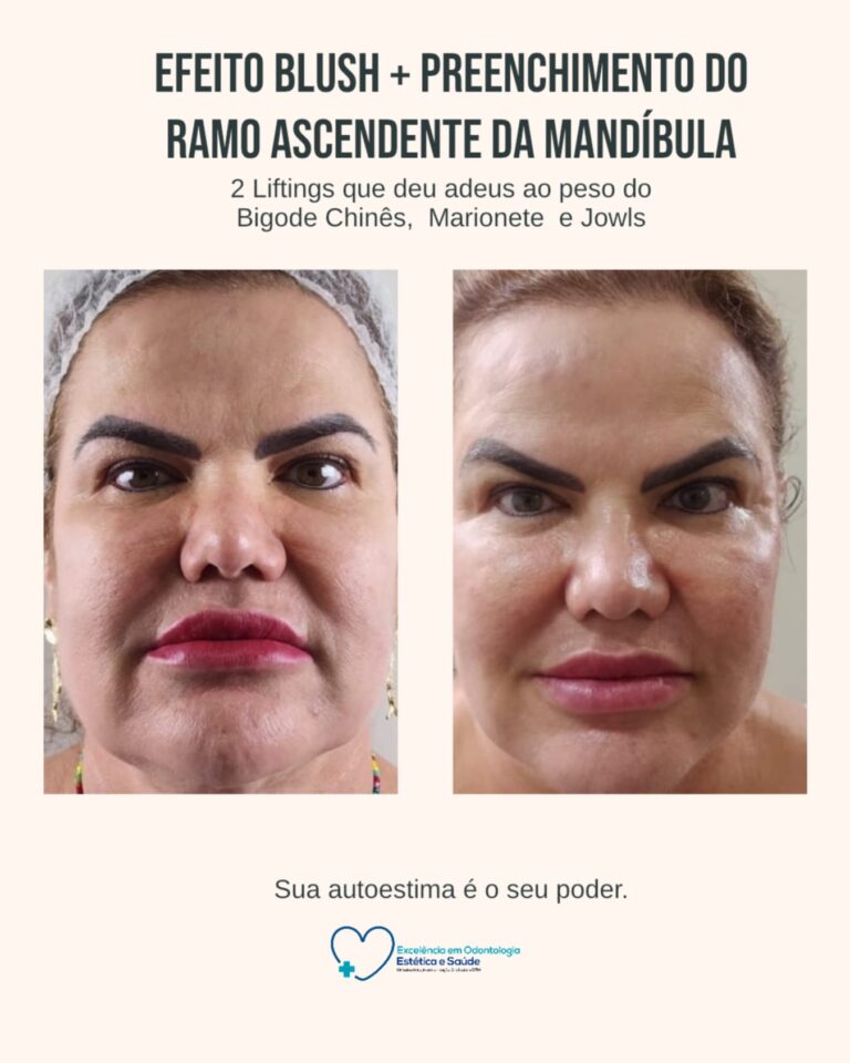 Artes e posts · Facecorp Estética Avançada, Saúde e Harmonização Oro Facial — Vila Imperial, São José do Rio Preto - SP