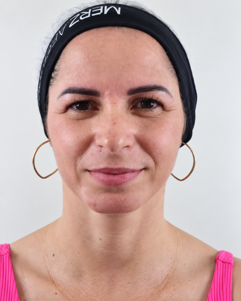 Estética facial · Facecorp Estética Avançada, Saúde e Harmonização Oro Facial — Vila Imperial, São José do Rio Preto - SP