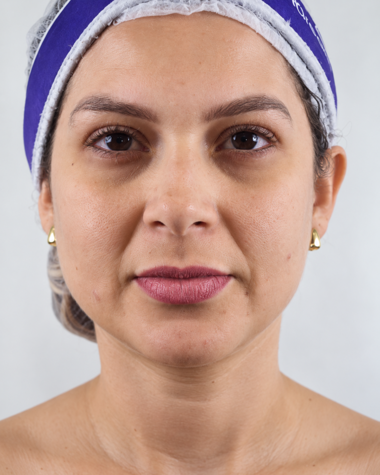 Estética facial · Facecorp Estética Avançada, Saúde e Harmonização Oro Facial — Vila Imperial, São José do Rio Preto - SP
